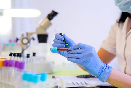 Examenes de Laboratorio